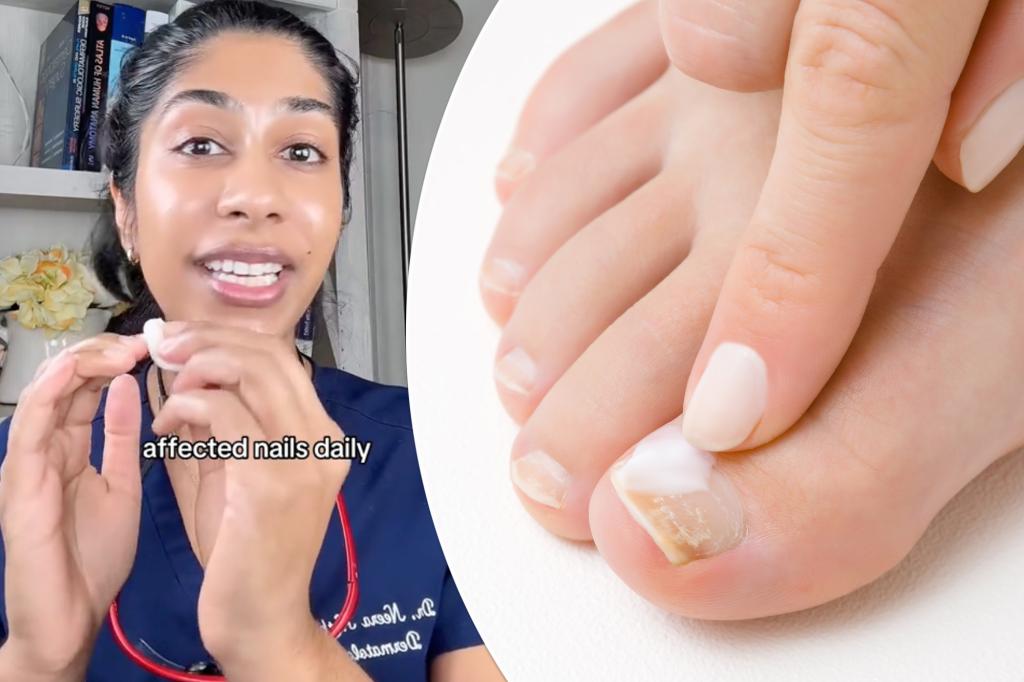 An inexpensive oral health supplement can treat toenail fungus